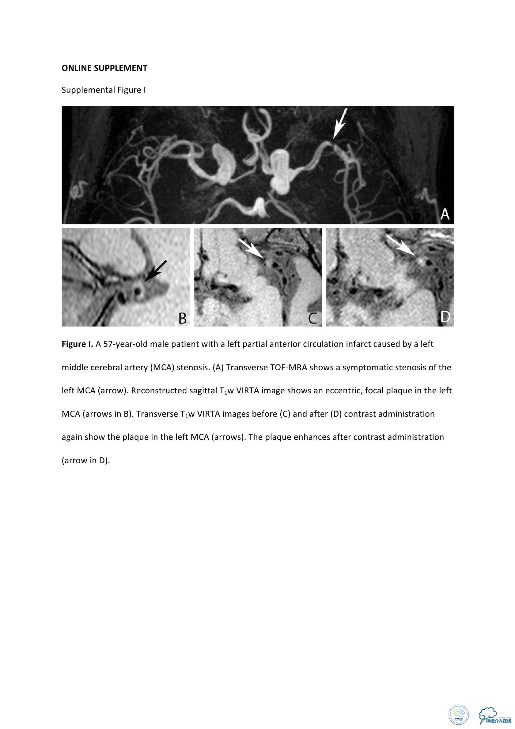 动脉粥样硬化疾病的影像诊断,脑动脉粥样硬化大脑的形态学变化