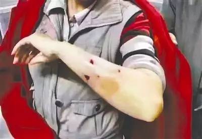 狗如果有狂犬病打疫苗有效吗,狗打针能预防狂犬病吗