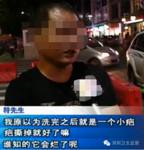 洗纹身感染出脓溃烂会不会留疤,洗纹身伤口发炎溃烂多久不疼