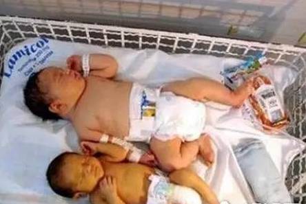 顺产12斤巨婴,42岁孕妈生12斤巨婴