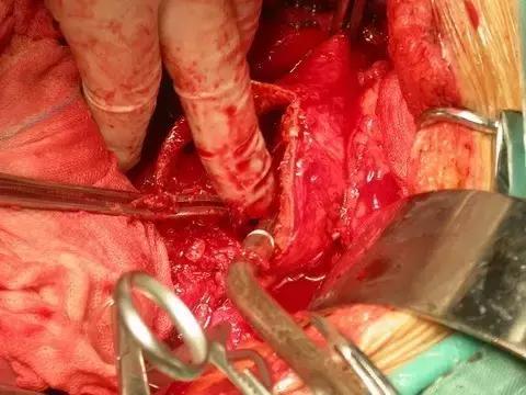 有一种病英文名,有一种病