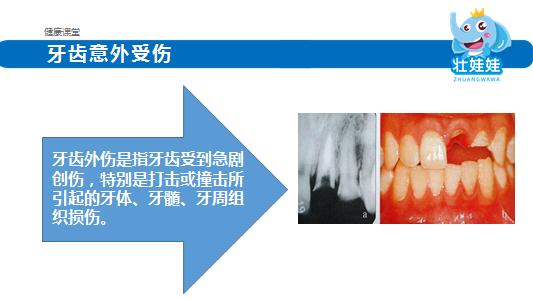 远离牙齿危机这八招快学起来,牙齿意外险
