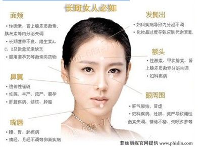 褐青色斑可以淡化吗,褐青色斑和雀斑哪个容易祛