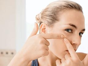 对付痘痘用哪些护肤品,针对痘痘肌的方案