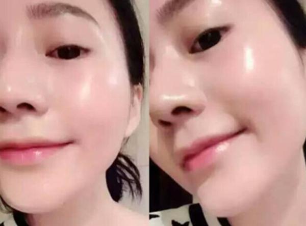 敏感肌的5个温柔抗衰老妙计,教你四个技巧拯救敏感肌