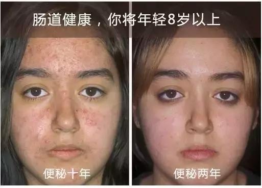 生活在寒冷地方的的人寿命更长吗,干净水源对寿命重要性