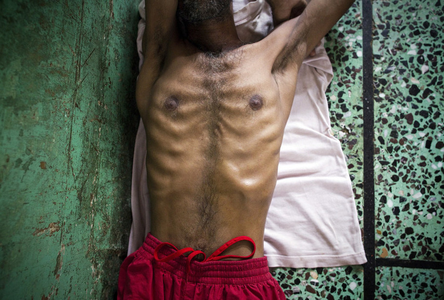 梅爹科普：吸毒导致死亡的主要原因是这三个