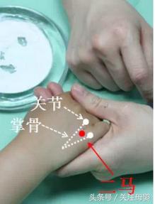 鹅口疮推拿用什么穴位,小儿鹅口疮护理措施