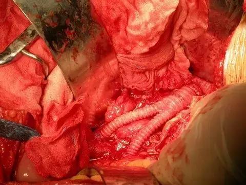 有一种病英文名,有一种病