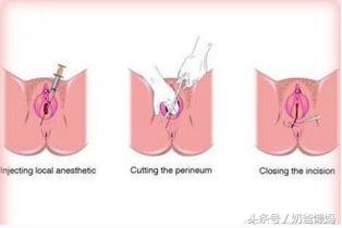 生孩子开几指了意味着什么?那些事你真的明白吗?