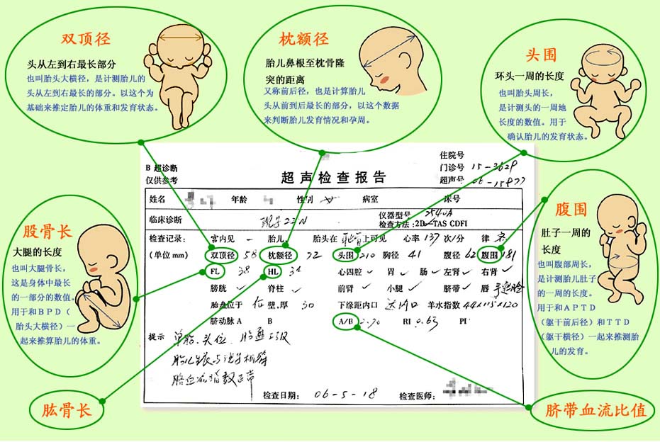 教你轻松看懂孕期b超专用术语,孕妈孕期必须检查的项目