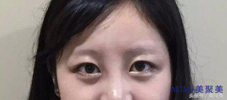 刚做的眉毛又粗又直怎么补救,刚做的眉毛怎么可以颜色淡点