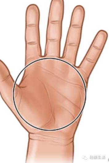 针对糖尿病人的膳食指南包括,糖尿病饮食指南食谱量表