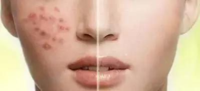 马油面霜到底好不好用,马油面霜的功效