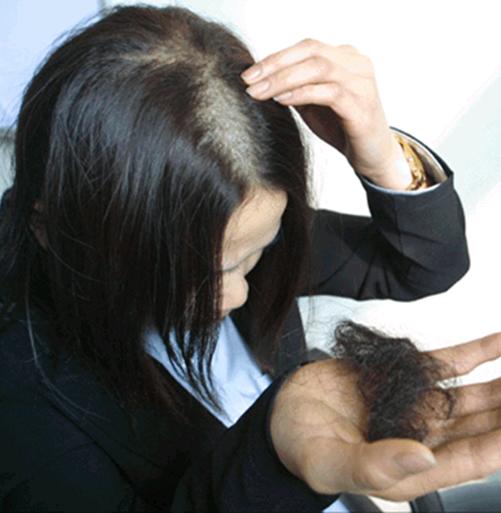 关于脱发的原因和治疗效果