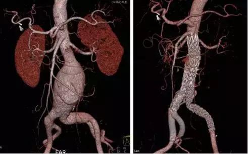 有一种病英文名,有一种病