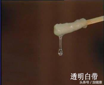 改善白带异常饮食有良方,从中医角度看白带异常