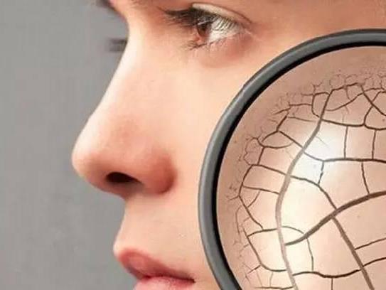 秋冬脸干燥起皮用什么护肤品,在秋季干燥肌肤该怎样去拯救