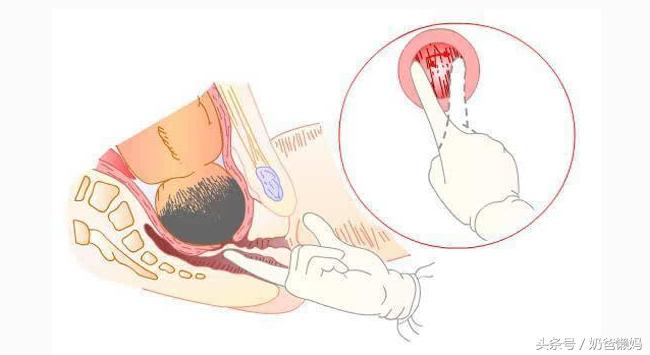 生孩子开几指了意味着什么?那些事你真的明白吗?