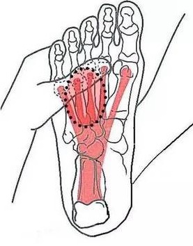 鞋子合不合适只有脚知道相似句子,鞋不合适脚中趾疼痛是什么原因