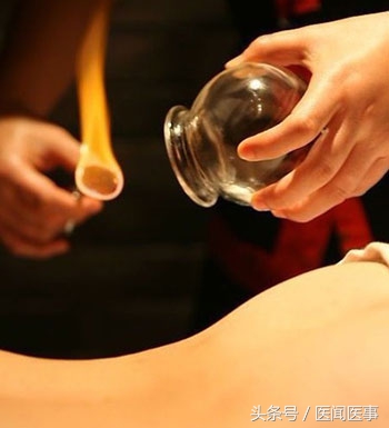 拔火罐拔出来的水泡真的是湿气吗,拔火罐拔出的湿气是肉湿还是外湿