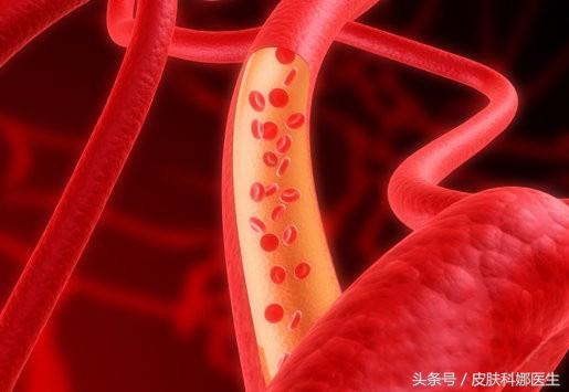 宝宝身上长了血管瘤要怎么治疗,肝上长血管瘤0.7x0.8要不要治疗