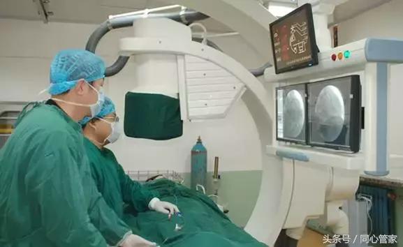 做完支架以后首次复查有哪些项目,颈动脉放支架一年后复查哪些项目