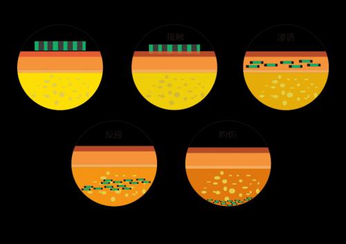 酸碱腐蚀性灼伤如何处理,酸碱灼伤的处理方法