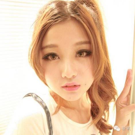 双眼皮变脸真实案例,网红双眼皮最成功的