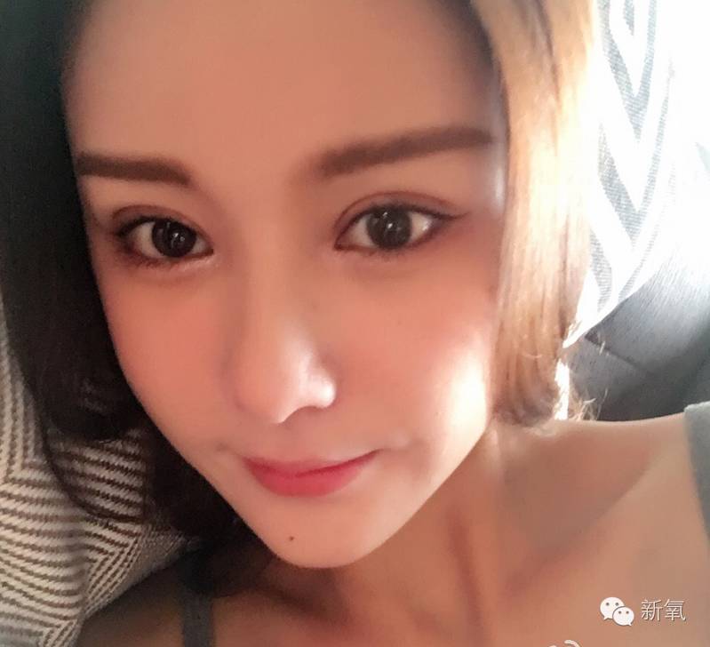 双眼皮变脸真实案例,网红双眼皮最成功的