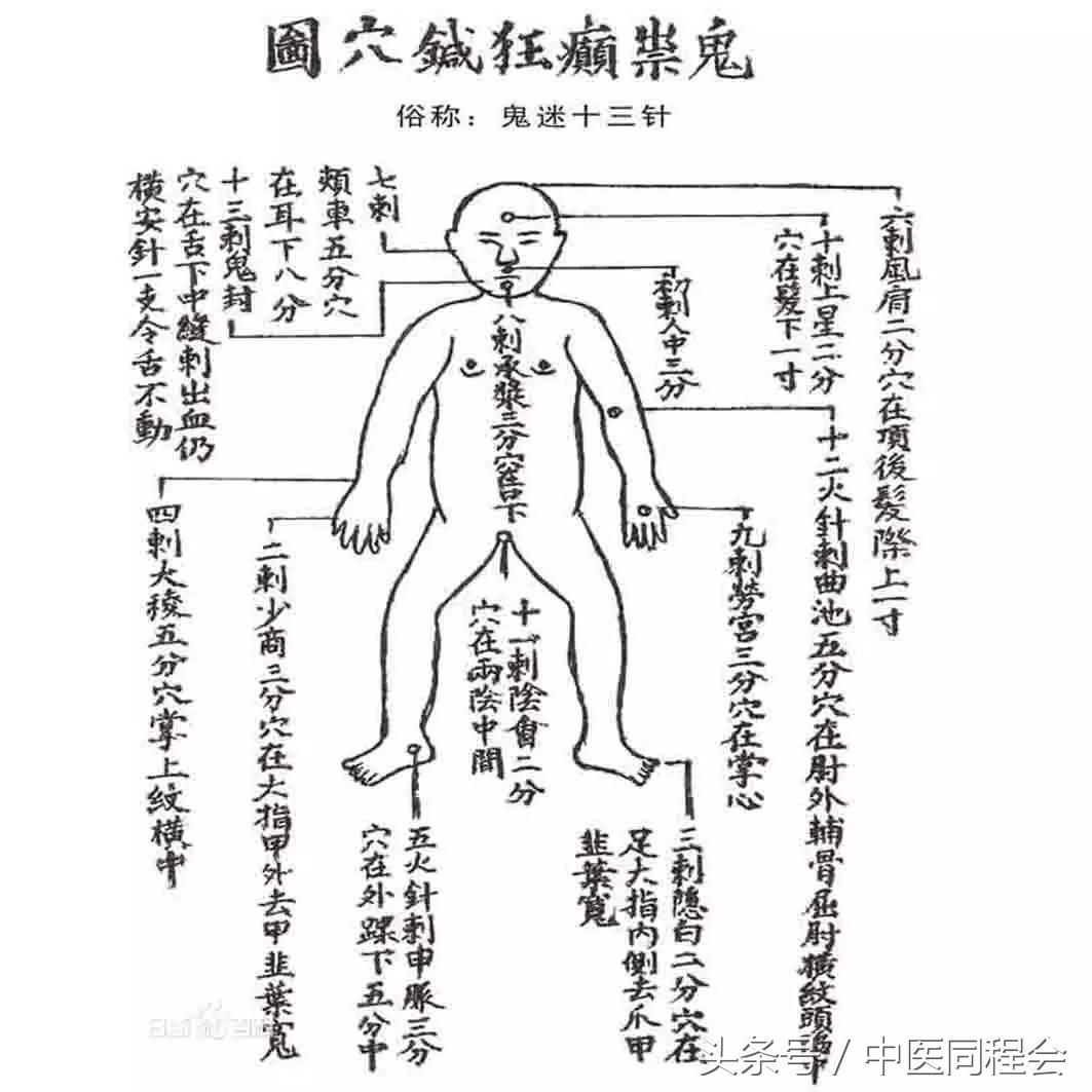 万圣节|看中医怎么与“鬼”混