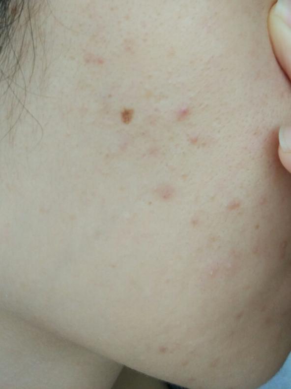 精准护肤问答,护肤问答每天解决一个小问题