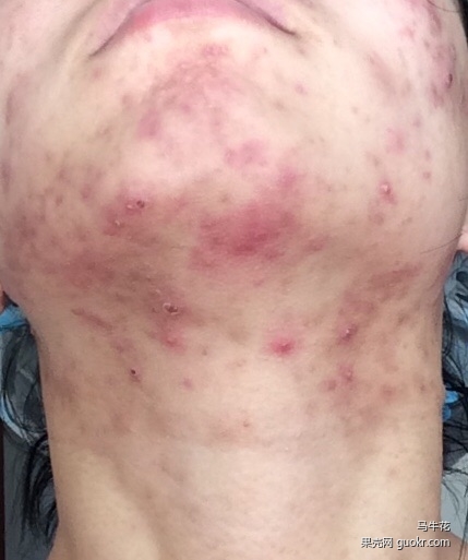 精准护肤问答,护肤问答每天解决一个小问题