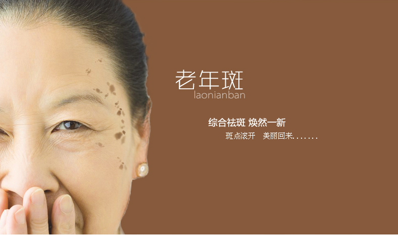 如何预防老年斑和黄褐斑,如何预防老年斑最有效方法