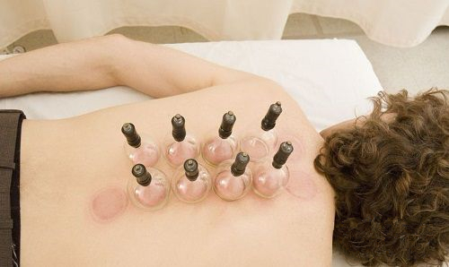 怎么通过拔罐的颜色判断身体状况,肩膀拔罐后颜色黑紫是怎么回事