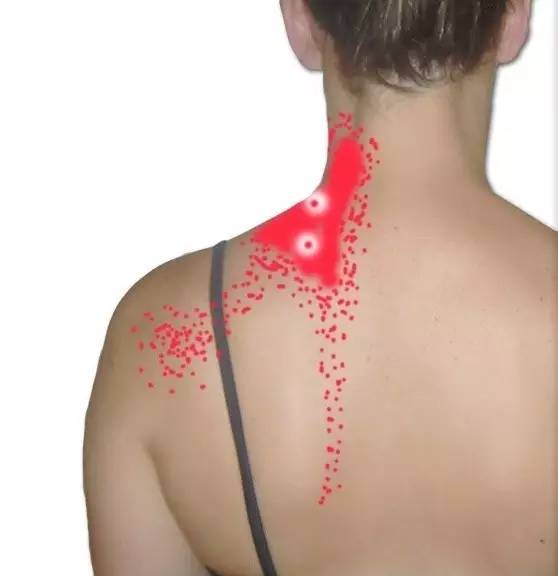 落枕后的疼痛瑜伽怎么弄,颈部落枕瑜伽解决办法