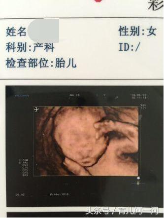 二胎b超显示三胞胎,b超一胎二胎小孩不一样