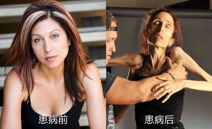 如何快速减肥减掉100斤,瘦身秘诀最简单的8个瘦身绝招