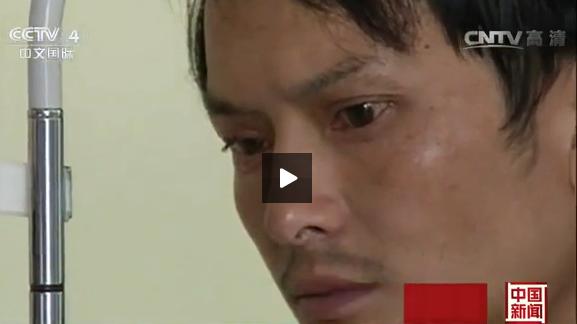 三星S6竟会喷火！险把小伙眼睛烧瞎，客服：伤处理不了！