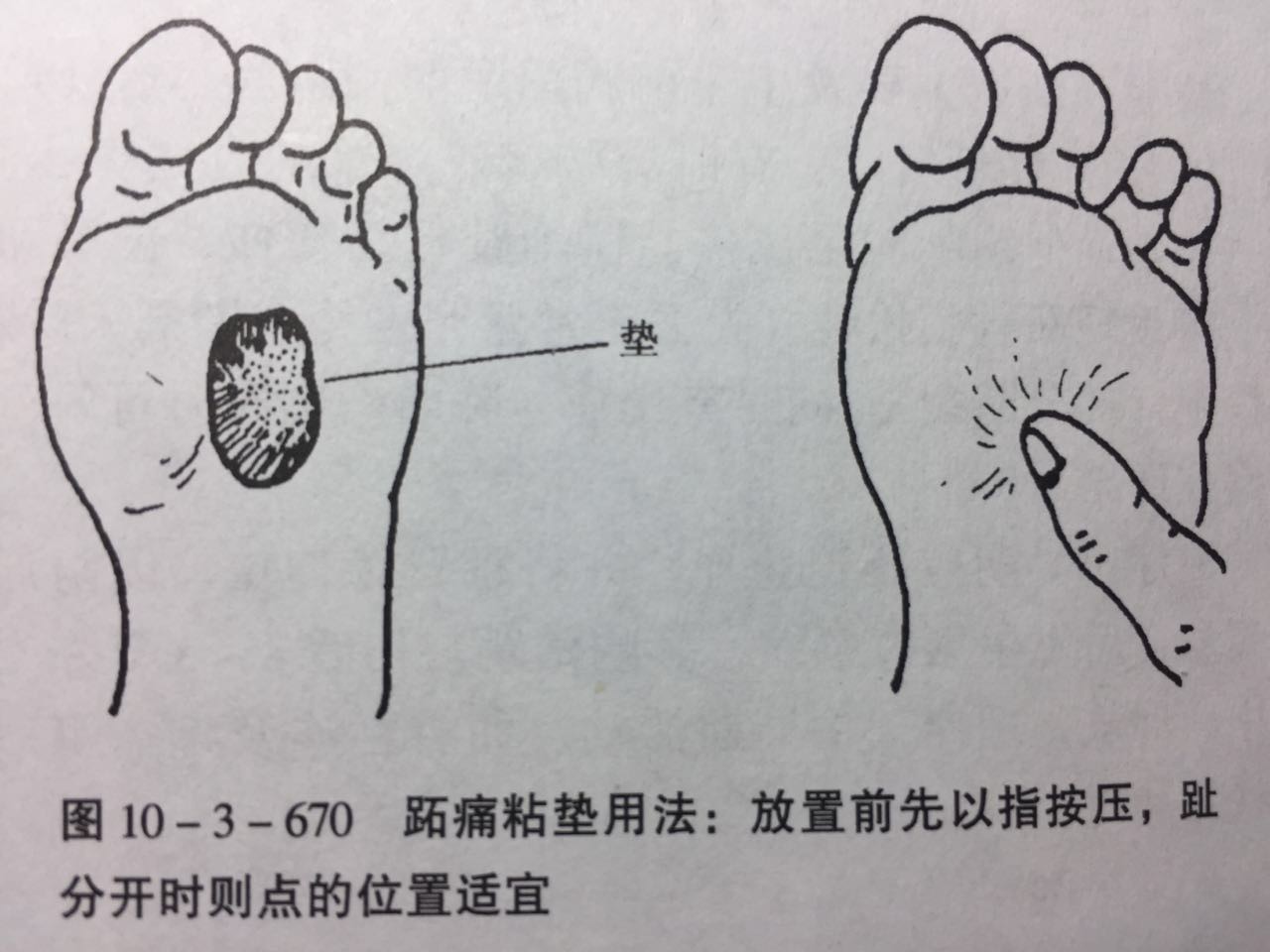 鞋子合不合适只有脚知道相似句子,鞋不合适脚中趾疼痛是什么原因