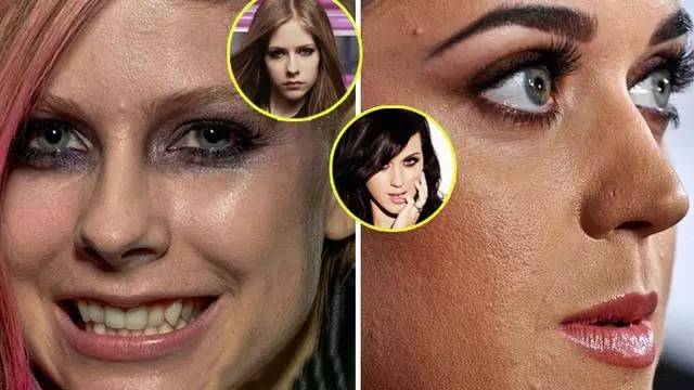 赵丽颖黑头怎么去掉,赵丽颖黑头去除方法