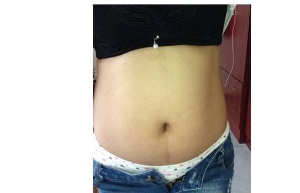 怀孕11周白带突然异常，匆忙赶到医院，检查结果让我生不如死！