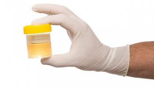 怀孕多长时间检查结果最精确,怀孕多久做检查能看孩子智力