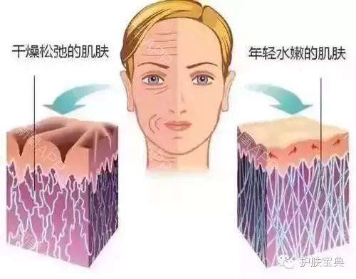 特别在意抬头纹怎么办,有人会在意抬头纹么