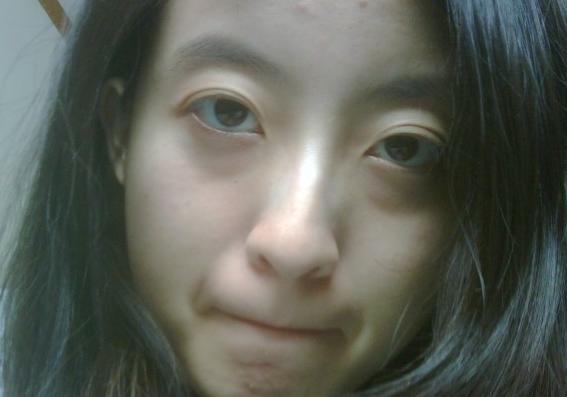 为什么有些人天生眼袋那么严重,为什么有人天生有眼袋