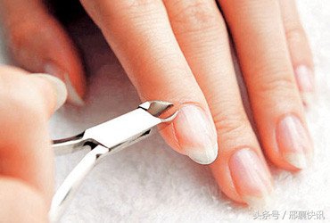 小孩灰指甲初期症状,手上有灰指甲的症状