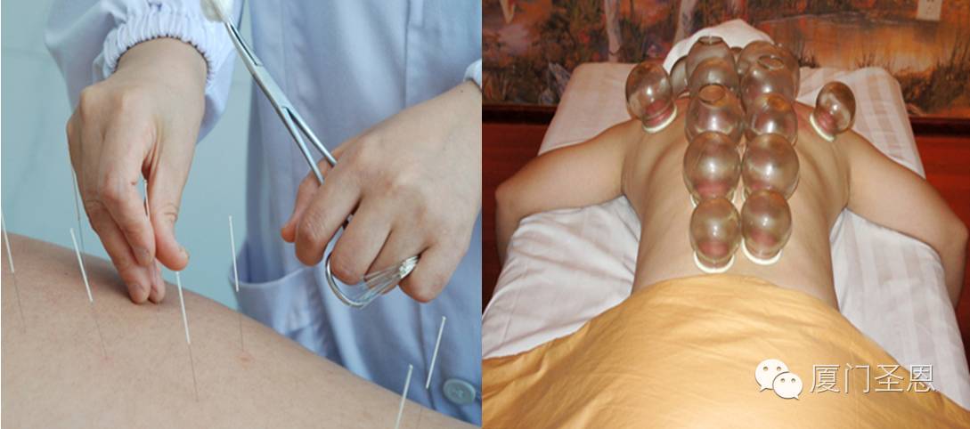 一针疗法治颈肩腰腿痛,颈肩腰腿痛的诊断治疗学