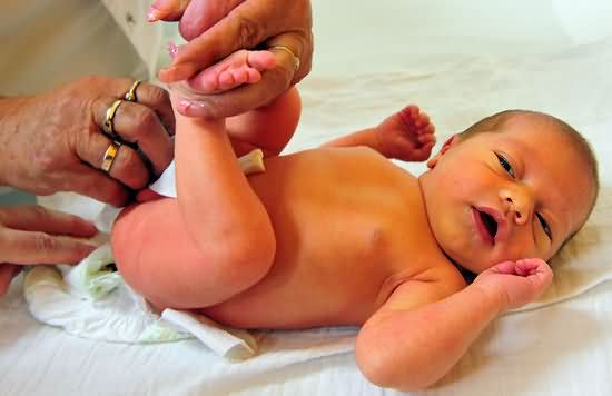 了解新生儿黄疸并进行适当治疗