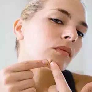 挤了多年的痘痘，你知道挤出来白色的物体是什么吗？