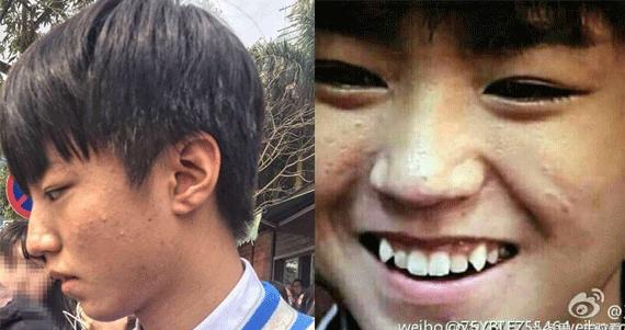 赵丽颖黑头怎么去掉,赵丽颖黑头去除方法